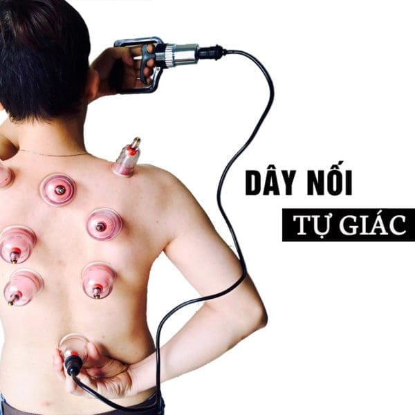Minh họa cách dùng dây nối