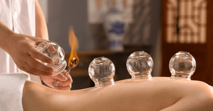 Giác hơi là phương pháp chữa bệnh trong Đông y