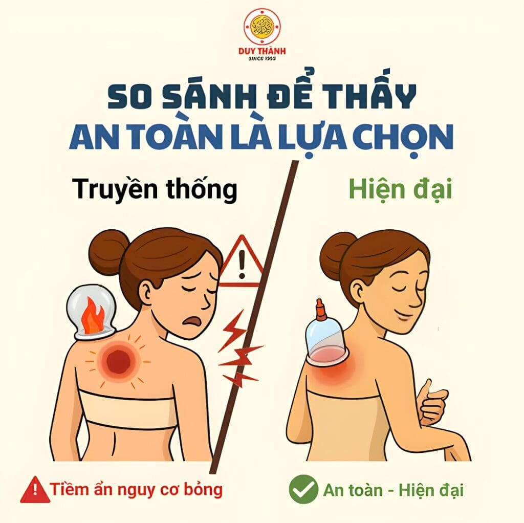 So sánh giác hơi truyền thống gây bỏng và giác hơi không dùng lửa an toàn, hiện đại